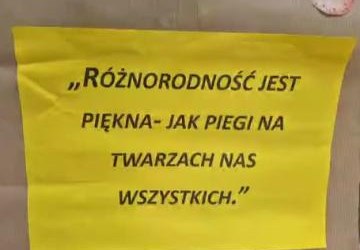 Dzień Piegów- każdy pieg to wyjątkowość! 