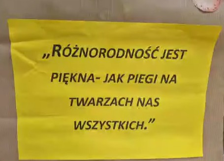 Dzień Piegów- każdy pieg to wyjątkowość! 